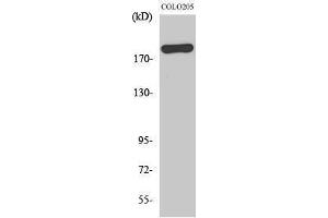 Image no. 1 for anti-BCL6 Co-Repressor (BCOR) (Internal Region) antibody (ABIN3183508)