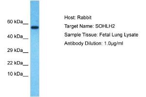 Image no. 1 for anti-Spermatogenesis and Oogenesis Specific Basic Helix-Loop-Helix 2 (SOHLH2) (N-Term) antibody (ABIN2774588)