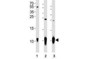 Image no. 4 for anti-S100 Calcium Binding Protein B (S100B) antibody (ABIN3032516)