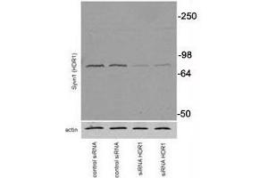Image no. 5 for anti-Synovial Apoptosis Inhibitor 1, Synoviolin (SYVN1) (AA 586-617) antibody (ABIN3029082)