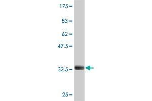Western Blot detection against Immunogen (32.
