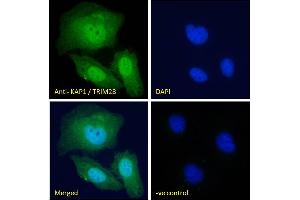 Image no. 5 for anti-Tripartite Motif Containing 28 (TRIM28) (C-Term) antibody (ABIN184913)