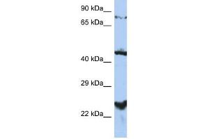 anti-MRS2 Magnesium Homeostasis Factor Homolog (MRS2) (Middle Region) antibody