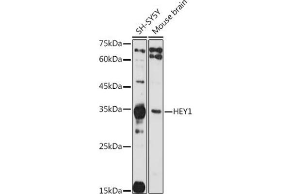 HEY1 anticorps  (AA 50-150)