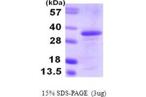 Image no. 1 for Cell Division Cycle Associated 8 (CDCA8) (AA 19-280) protein (His tag) (ABIN667908)