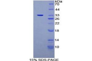 Image no. 1 for Cardiac Troponin I (TNNI3) protein (ABIN3012039)