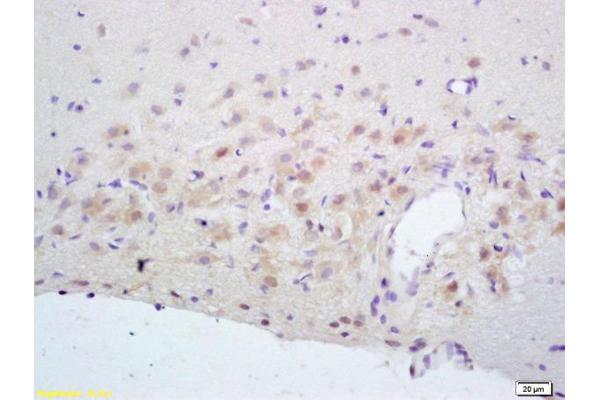 NMDAR2A antibody  (AA 851-950)