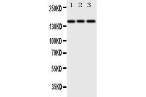 Image no. 2 for anti-V-Erb-A erythroblastic Leukemia Viral Oncogene Homolog 4 (Avian) (ERBB4) (AA 35-51), (N-Term) antibody (ABIN3044100)