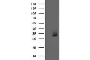 Image no. 2 for anti-Aquaporin 1 (Colton Blood Group) (AQP1) antibody (ABIN2716313)