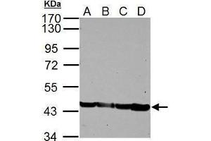 Image no. 2 for anti-Actin, alpha 1, Skeletal Muscle (ACTA1) (Center) antibody (ABIN2855023)
