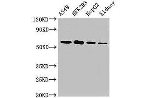 Image no. 3 for anti-Prolyl 4-Hydroxylase, alpha Polypeptide I (P4HA1) (AA 256-525) antibody (ABIN6091599)