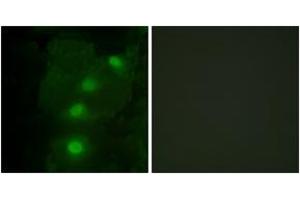 Image no. 2 for anti-ALX Homeobox 3 (ALX3) (AA 171-220) antibody (ABIN1533554)