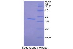 Image no. 1 for Salt-Inducible Kinase 2 (SIK2) (AA 674-916) protein (His tag) (ABIN1878335)