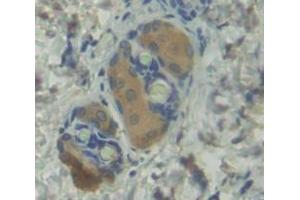 Image no. 2 for anti-Bone Morphogenetic Protein 1 (BMP1) (AA 856-982) antibody (ABIN1173363)