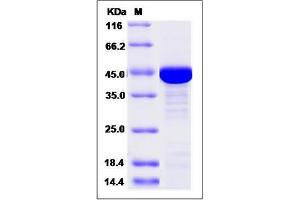 Image no. 1 for Creatine Kinase, Muscle (CKM) (AA 1-381) protein (His tag) (ABIN3214469)