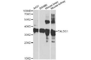 Image no. 1 for anti-Transaldolase 1 (TALDO1) antibody (ABIN6148838)