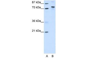 Image no. 1 for anti-TOX High Mobility Group Box Family Member 4 (TOX4) (N-Term) antibody (ABIN925916)