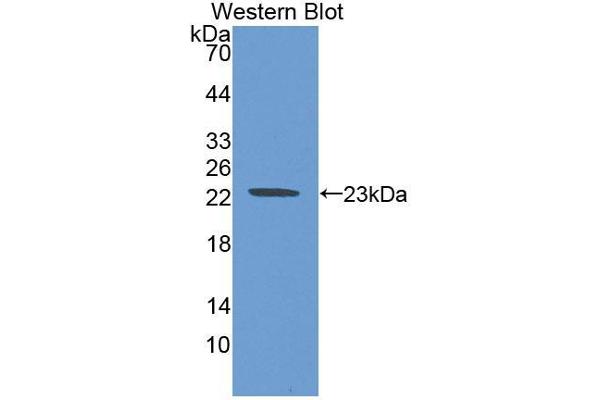 CLMP antibody  (AA 19-183)