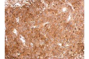IHC-P Image Tau antibody detects MAPT protein at cytosol on D54MG xenograft by immunohistochemical analysis.