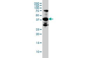 Image no. 2 for anti-Uroporphyrinogen Decarboxylase (UROD) (AA 268-367) antibody (ABIN521280)