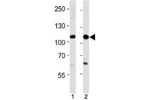 Image no. 2 for anti-Sal-Like 4 (SALL4) (AA 1009-1039) antibody (ABIN3028999)