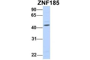 Image no. 2 for anti-Zinc Finger Protein 185 (ZNF185) (N-Term) antibody (ABIN2780833)