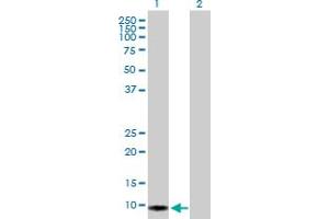 Image no. 3 for anti-S100 Calcium Binding Protein A2 (S100A2) (AA 1-97) antibody (ABIN519948)