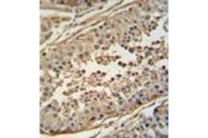 Image no. 2 for anti-F-Box Protein 24 (FBXO24) (AA 118-145), (Middle Region) antibody (ABIN952285)