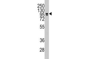 Image no. 1 for anti-CCAAT/enhancer Binding Protein (C/EBP), zeta (CEBPZ) (AA 1001-1029) antibody (ABIN3028540)
