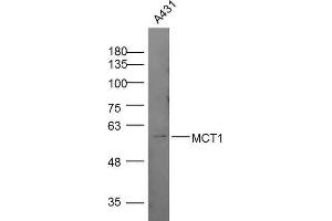 Image no. 1 for anti-Malignant T Cell Amplified Sequence 1 (MCTS1) (AA 251-350) antibody (ABIN1714919)