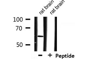 Image no. 1 for anti-Cleavage Stimulation Factor, 3' Pre-RNA, Subunit 2, 64kDa (CSTF2) antibody (ABIN6258037)
