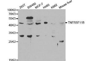 Image no. 2 for anti-Tumor Necrosis Factor Receptor Superfamily, Member 11b (TNFRSF11B) antibody (ABIN3022915)