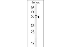TRIM59 anticorps  (N-Term)