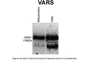 Image no. 2 for anti-Valyl-tRNA Synthetase (VARS) (Middle Region) antibody (ABIN2782517)