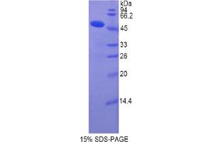 Image no. 1 for Collagen, Type XIV, alpha 1 (COL14A1) protein (ABIN3008902)