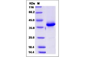 Image no. 1 for Calcitonin-Related Polypeptide beta (CALCB) (AA 1-118) protein (Fc Tag) (ABIN2005629)
