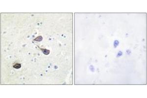 Image no. 1 for anti-Opioid Receptor, kappa 1 (OPRK1) (AA 331-380) antibody (ABIN1532312)