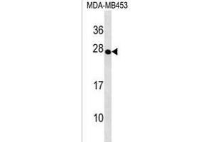TRDC Antibody (Center) (ABIN1538630 and ABIN2838134) western blot analysis in MDA-M cell line lysates (35 μg/lane).