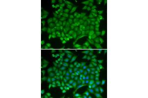 Image no. 2 for anti-RAB11A, Member RAS Oncogene Family (RAB11A) antibody (ABIN3021608)