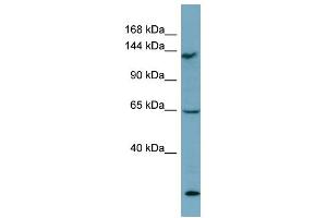 Image no. 1 for anti-LATS, Large Tumor Suppressor, Homolog 1 (Drosophila) (LATS1) (Middle Region) antibody (ABIN2787626)