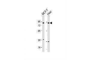 Image no. 2 for anti-Fibroblast Growth Factor Receptor Substrate 2 (FRS2) (AA 275-303) antibody (ABIN1538225)