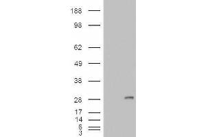 Image no. 1 for anti-Insulin-Like Growth Factor Binding Protein 6 (IGFBP6) (Internal Region) antibody (ABIN263197)