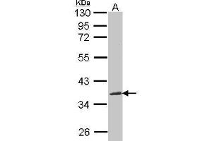Image no. 1 for anti-Nephroblastoma Overexpressed (NOV) (Center) antibody (ABIN2855618)