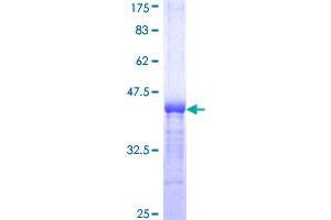 Image no. 1 for Branched Chain Keto Acid Dehydrogenase E1, alpha Polypeptide (BCKDHA) (AA 347-445) protein (GST tag) (ABIN1346527)
