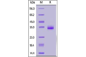 Image no. 2 for SARS-CoV-2 Spike S1 (B.1.351 - beta), (RBD) (Active) protein (His tag) (ABIN7013274)