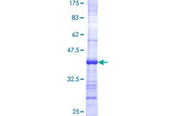 PHOSPHO1 Protein (AA 168-266) (GST tag)