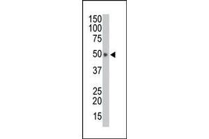 Image no. 1 for anti-HtrA Serine Peptidase 1 (HTRA1) (AA 389-419), (C-Term) antibody (ABIN356844)
