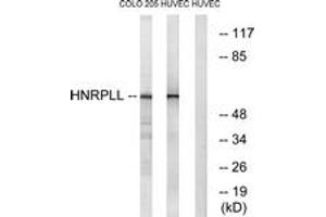 Image no. 1 for anti-Heterogeneous Nuclear Ribonucleoprotein L-Like (HNRPLL) (AA 241-290) antibody (ABIN1534976)