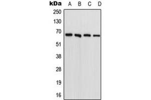 Image no. 1 for anti-Phenylalanyl-tRNA Synthetase, beta Subunit (FARSB) (N-Term) antibody (ABIN2707508)