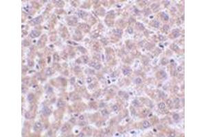 Immunohistochemistry of TIP47 in rat liver tissue with this product at 2 μg/ml.